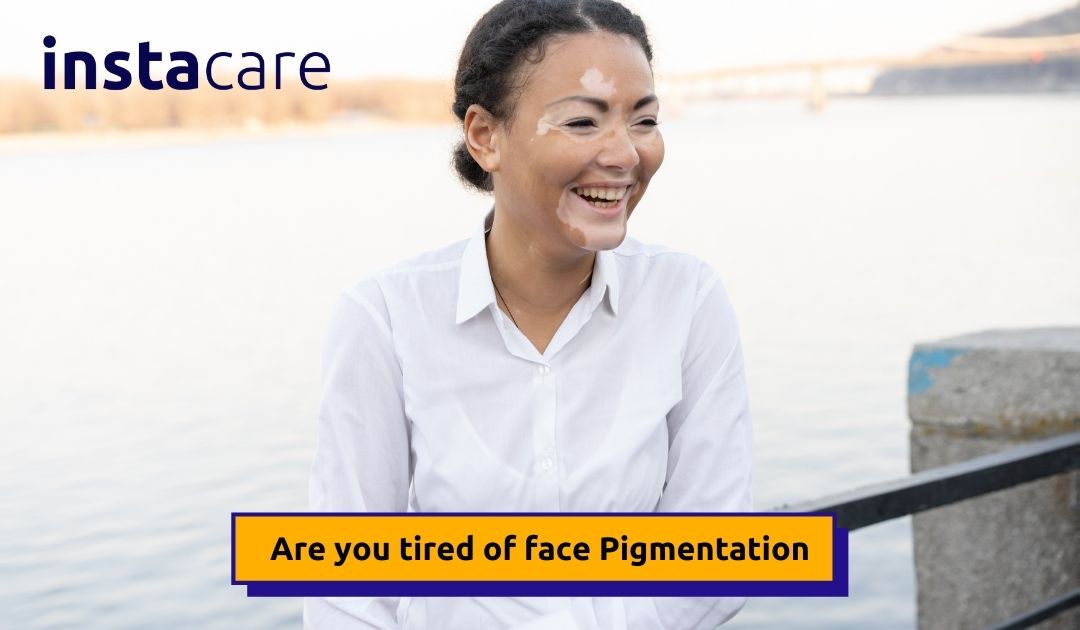 Picture of How to Remove Pigmentation From the Face Permanently Naturally