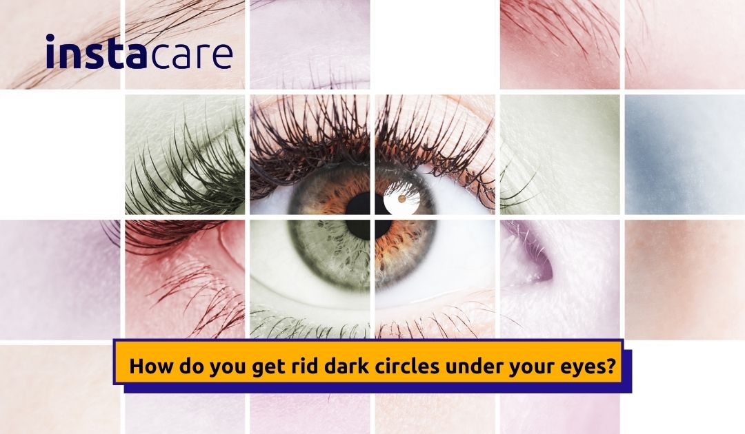 Picture of What Causes Dark Circles Under Your Eyes