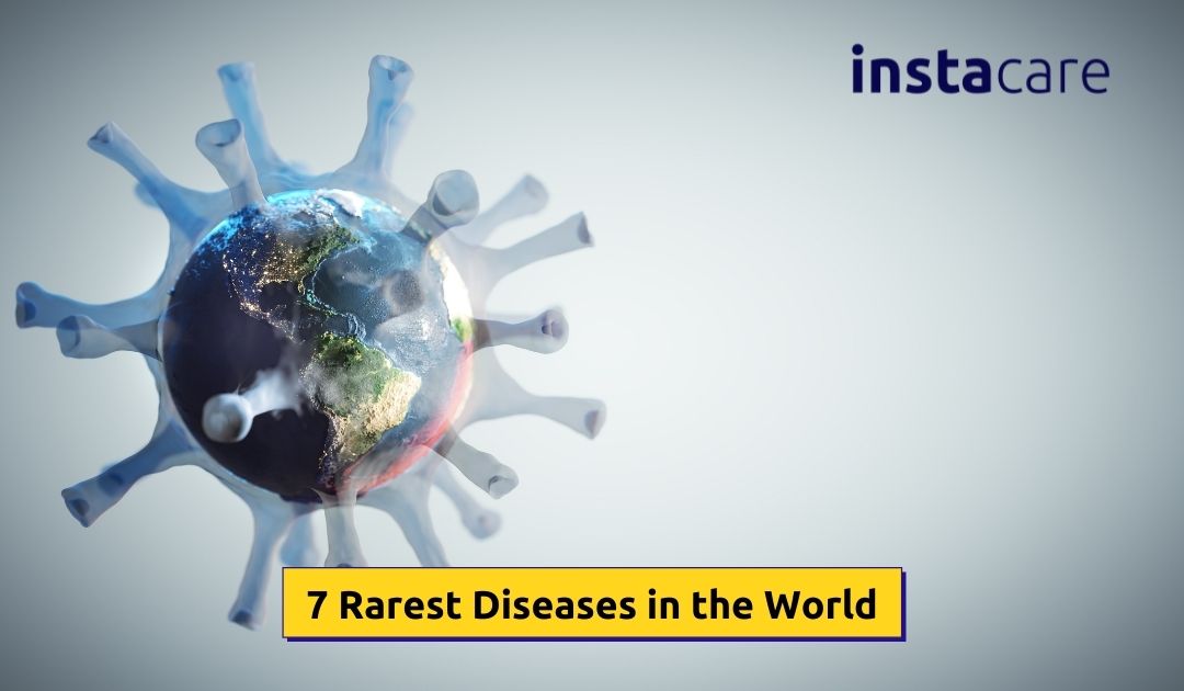 Picture of 7 Rarest Diseases in the World