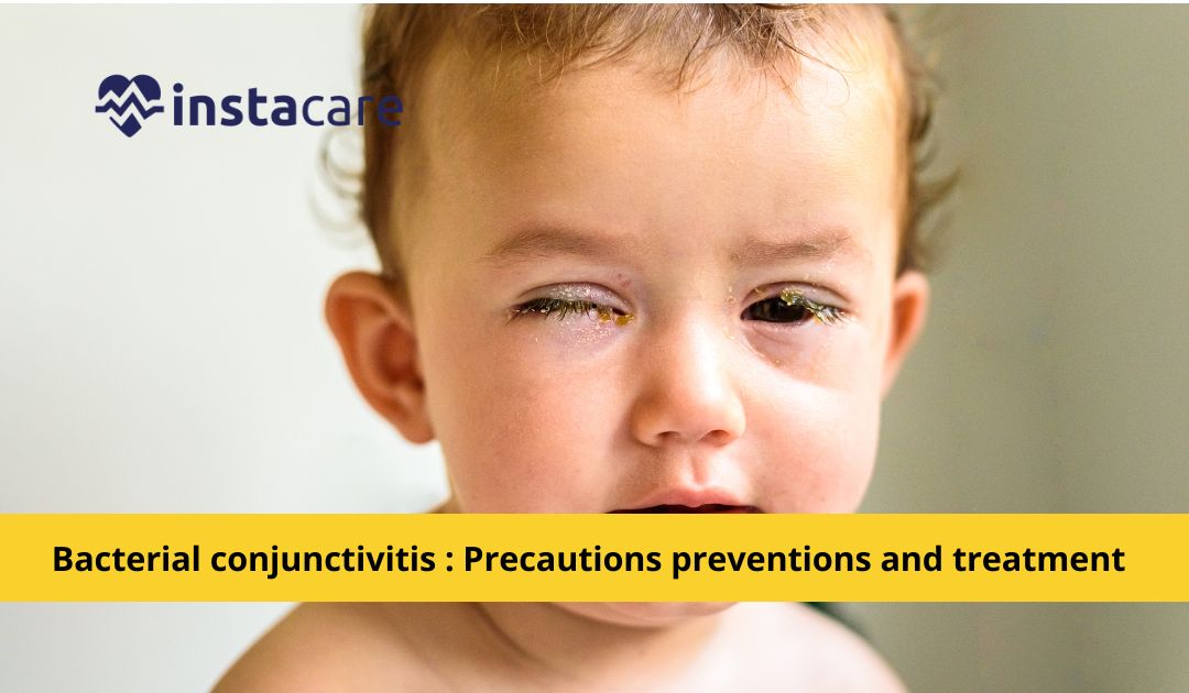 Picture of Bacterial conjunctivitis Precautions Preventions and Treatment
