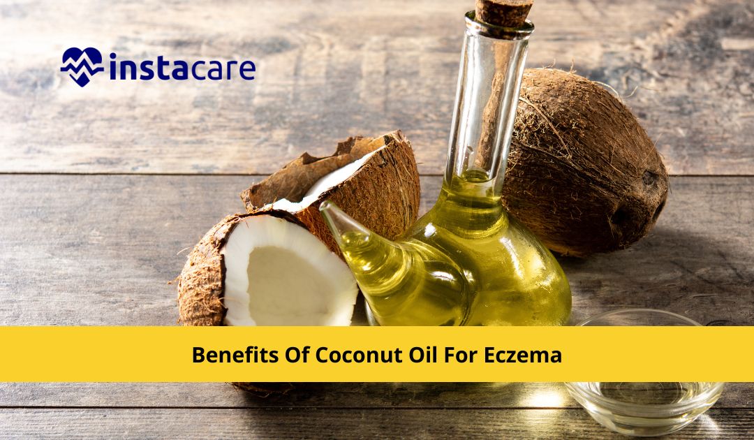 Benefits Of Coconut Oil For Eczema You Need To Know