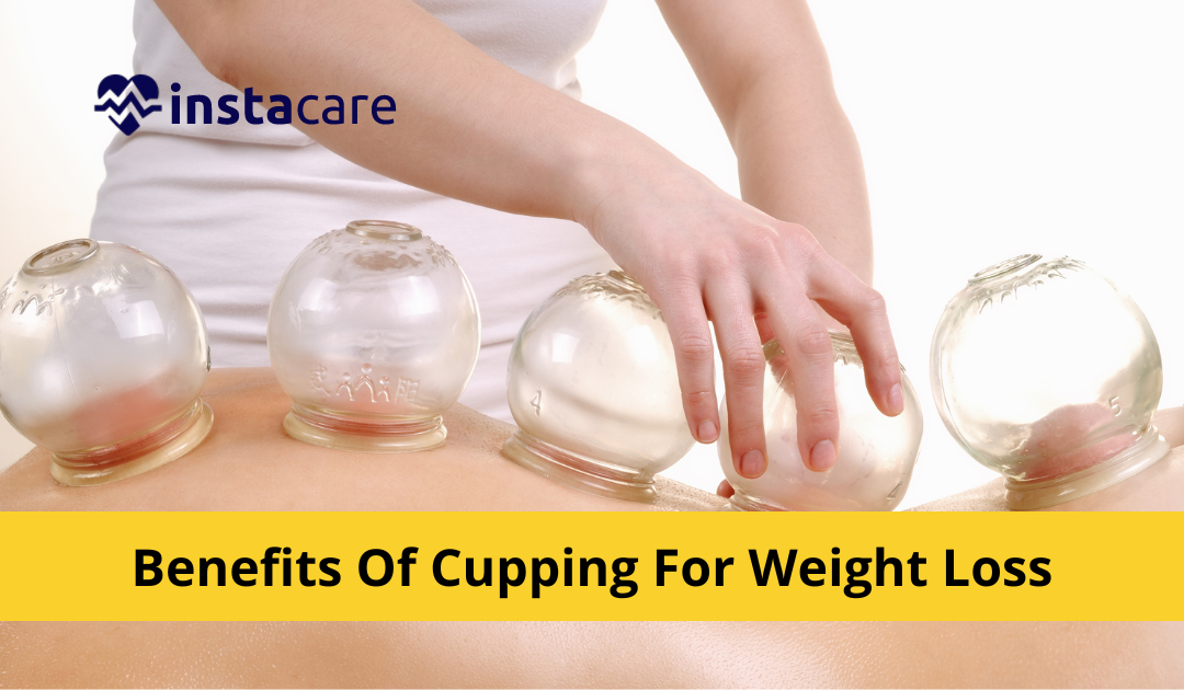 Picture of What Are The Benefits Of Cupping For Weight Loss
