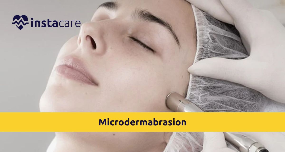 Picture of Top 7 Benefits Of Microdermabrasion You Should Be Knowing
