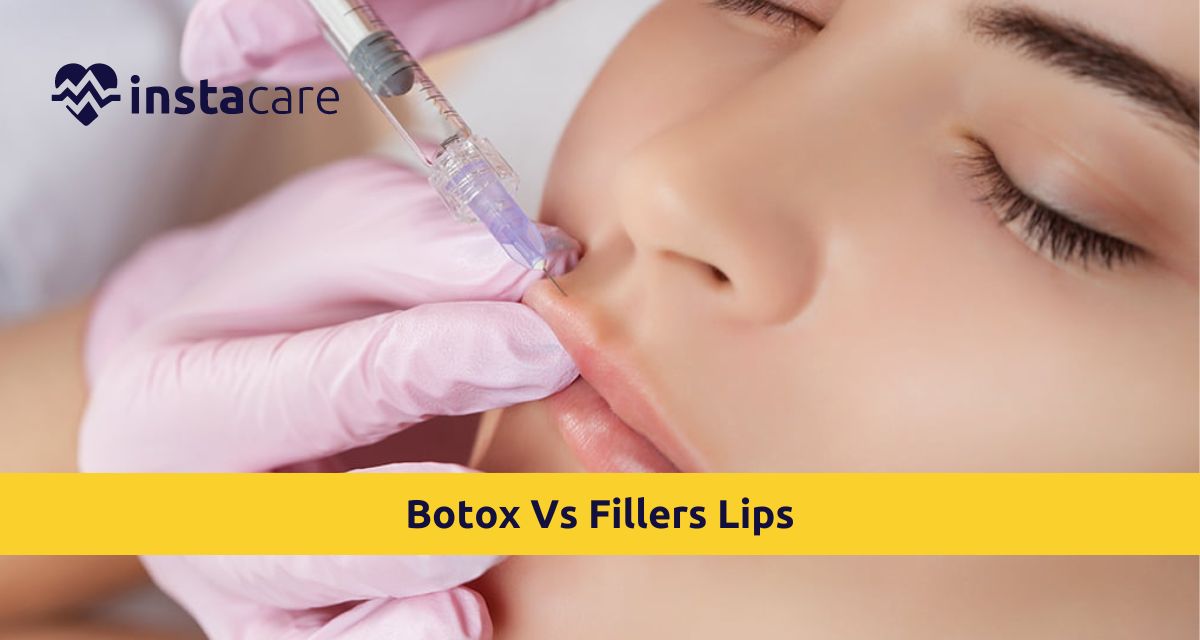 Picture of All You Must Know About Botox Vs Fillers Lips