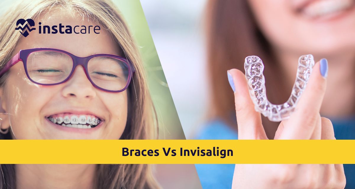 Picture of Braces Vs Invisalign Which is Right For Your Teeth