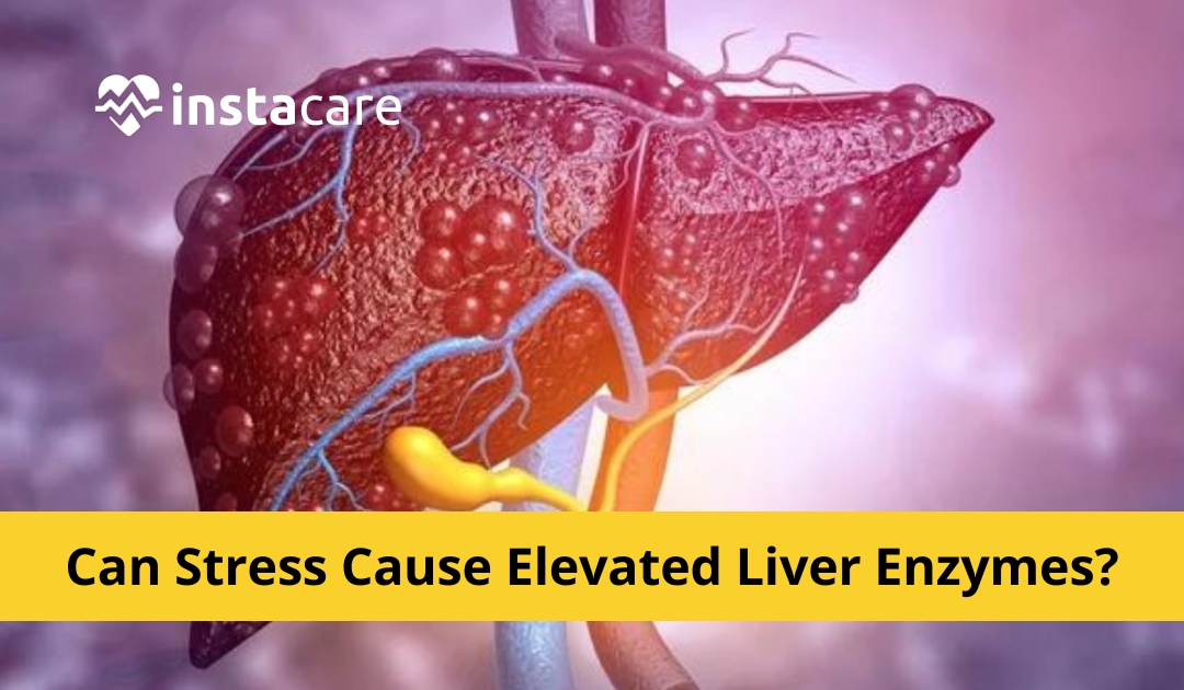 Picture of Can Stress Cause Elevated Liver Enzymes
