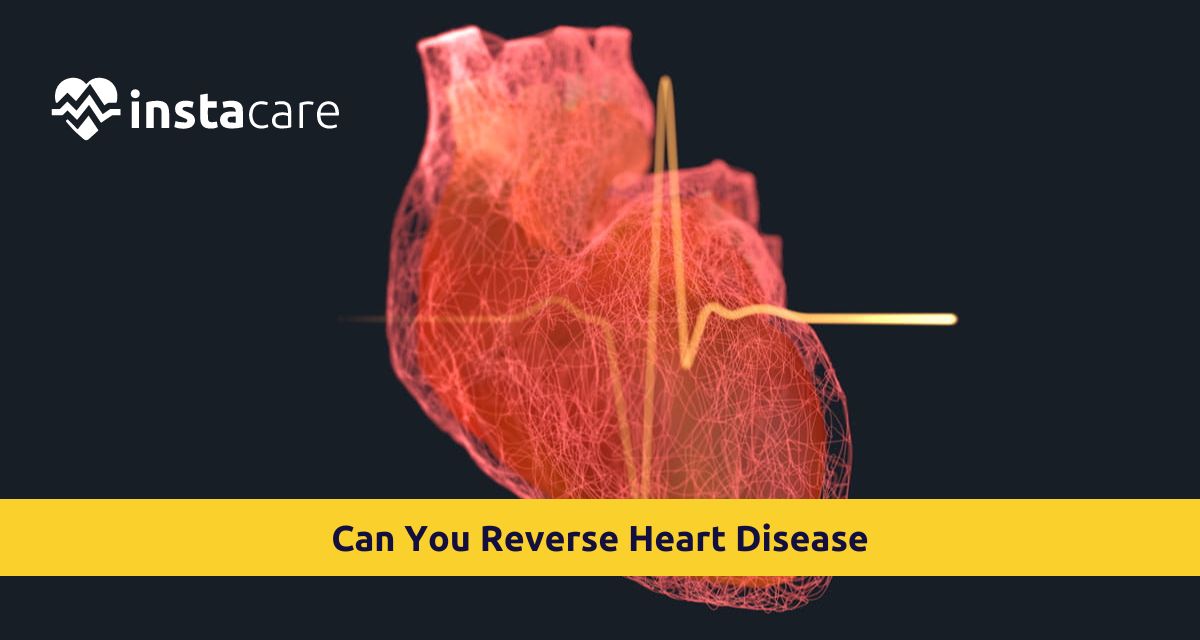 Picture of Can You Reverse Heart Disease