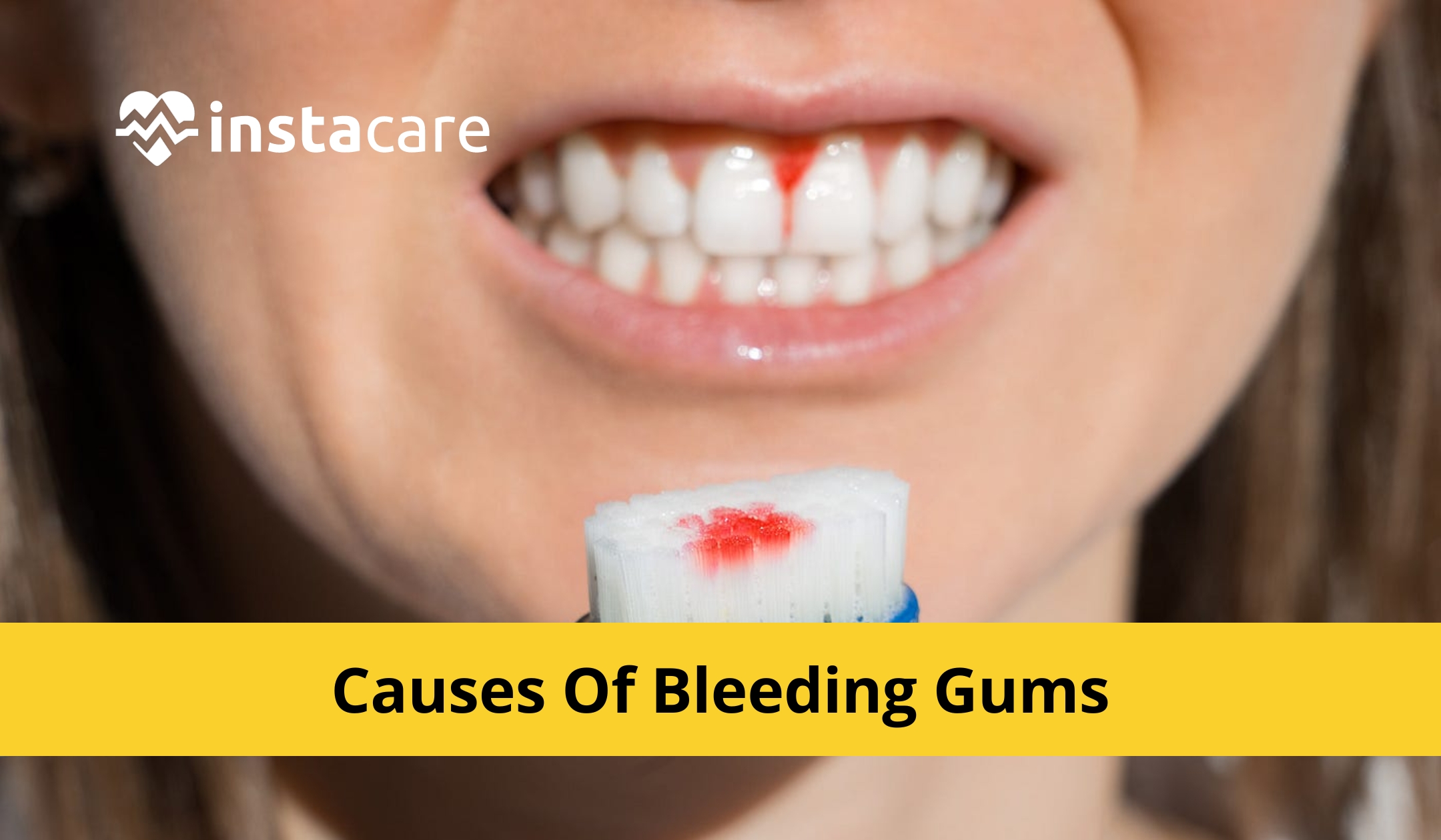 Picture of Various Causes Of Bleeding Gums And How You Can Treat It