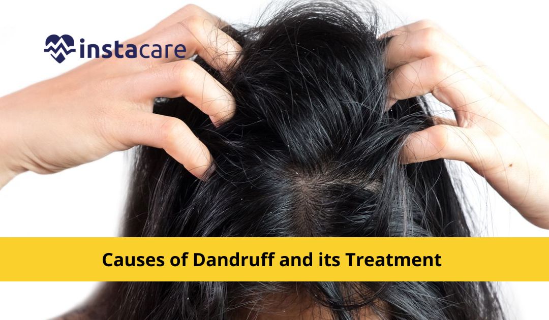 7 Causes Of Dandruff And Its Treatment