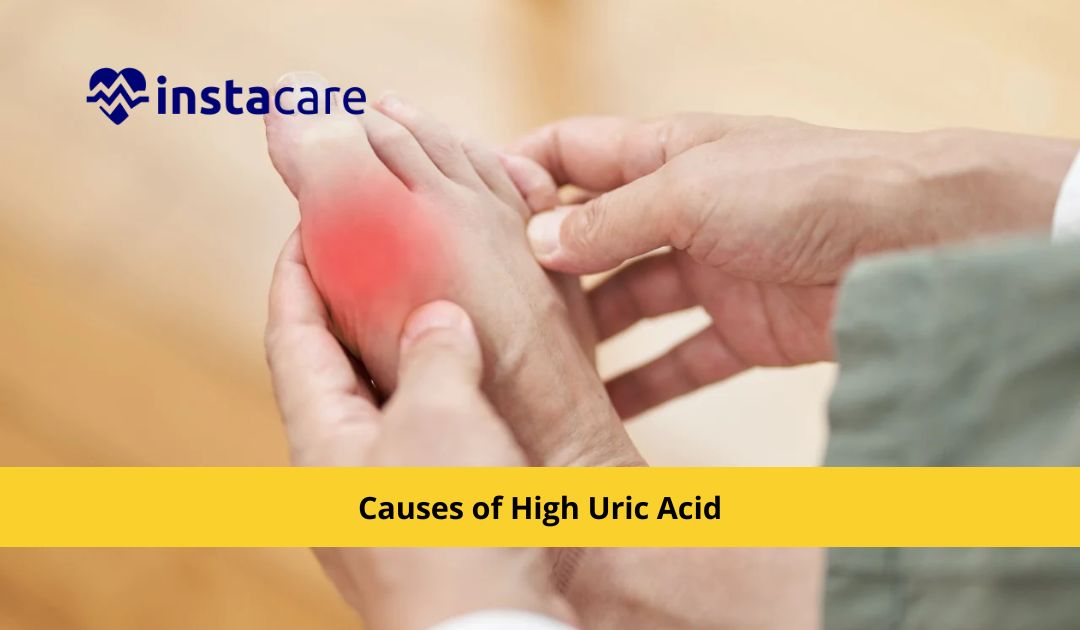 Picture of Causes of High Uric Acid In The Body Hyperuricemia
