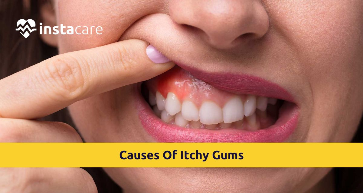 Picture of What Are Various Causes Of Itchy Gums