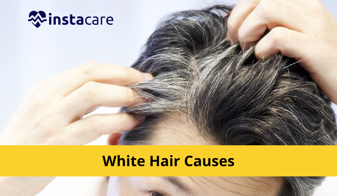 What are Causes Of White Hair And How To Prevent It?