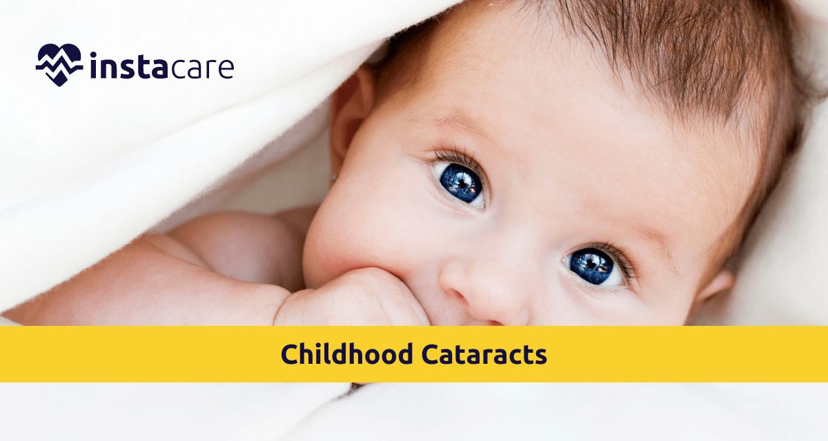 Picture of Childhood Cataracts How to Save Your Childs Vision