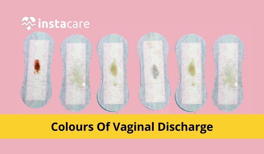 Yellowish, white or brown discharge: the color will tell you!