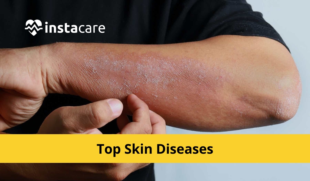 The 10 Most Common Skin Diseases And How To Treat Them