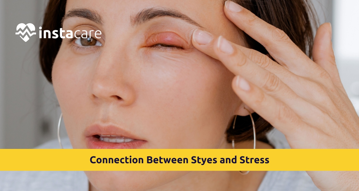 Picture of Is There a Connection Between Styes and Stress