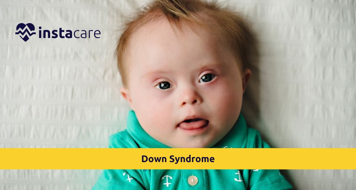 Picture of Down Syndrome