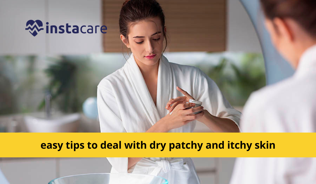 Picture of 6 easy tips to deal with dry patchy and itchy skin