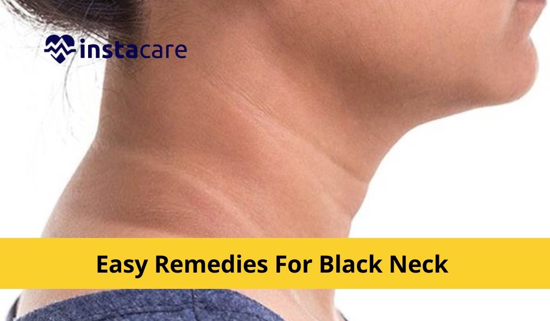 Picture of How To Get Rid Of A Black Neck With Simple - 14 Natural Remedies