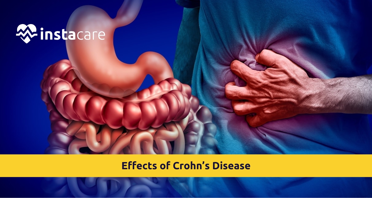 Picture of 7-Unexpected Effects of Crohns Disease