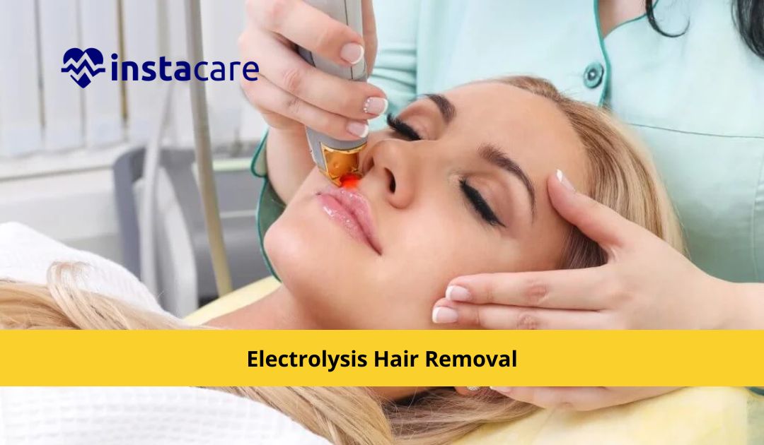 Electrolysis Hair Removal All Details and Procedures