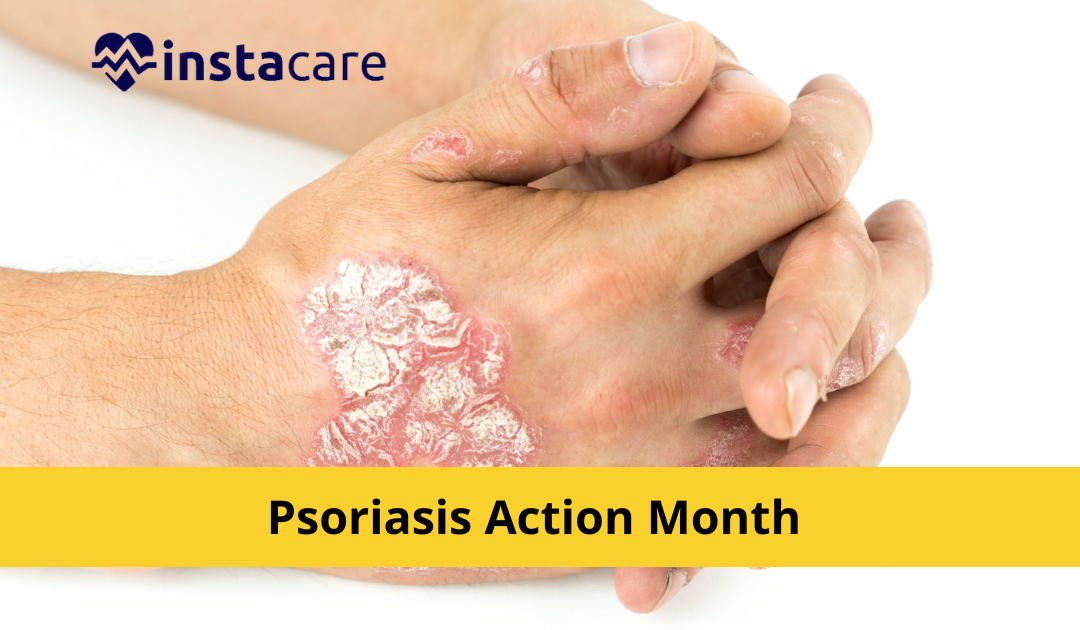 Picture of Everything You Should Know About Psoriasis Action Month