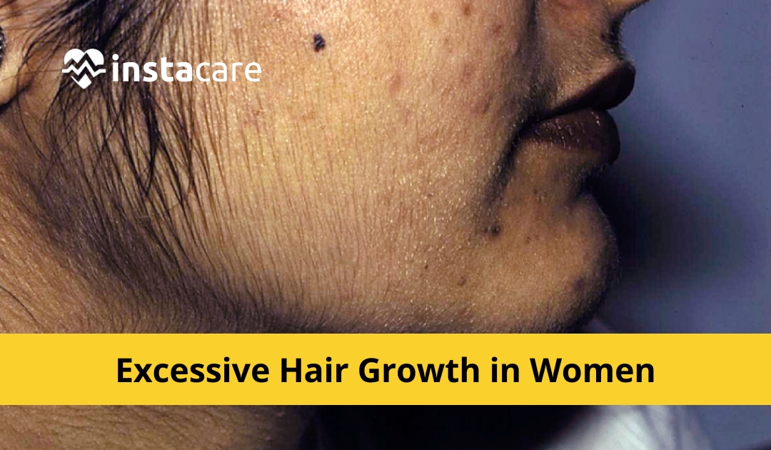 Excessive Hair Growth In Women - Hirsutism Treatment And Causes