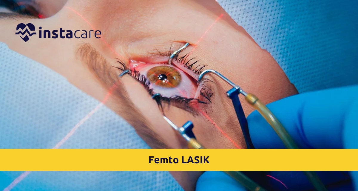 Picture of Femto LASIK A Revolutionary Approach to Vision Correction