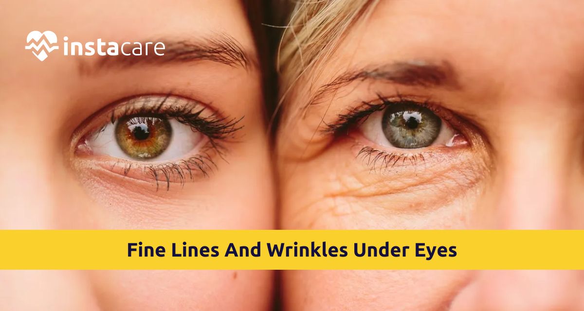 Picture of What You Must Know About Fine Lines And Wrinkles Under Eyes