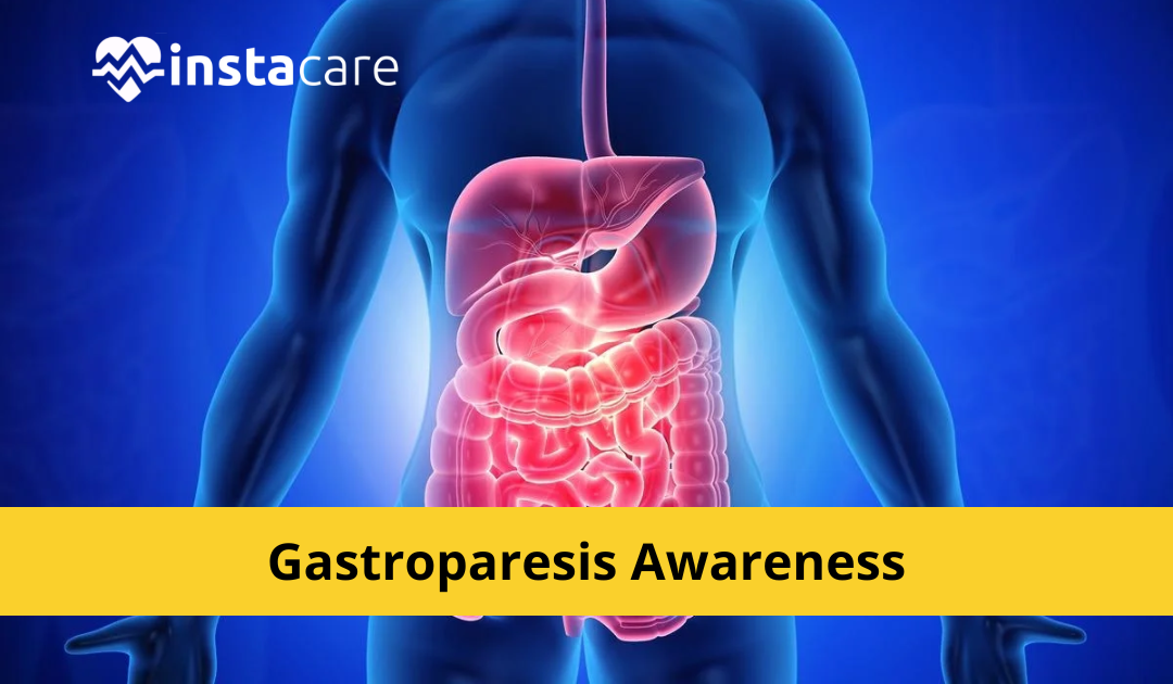 Picture of Gastroparesis Symptoms Causes Complications and Diagnosis