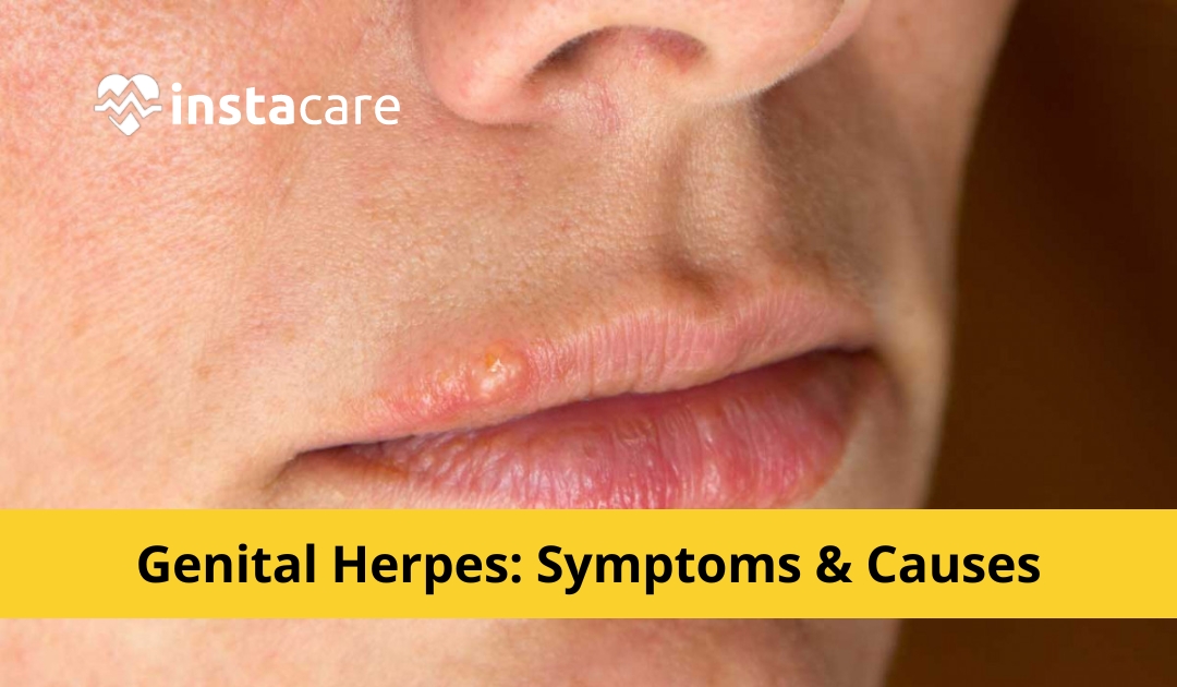 Picture of Genital Herpes Symptoms Causes And Treatment