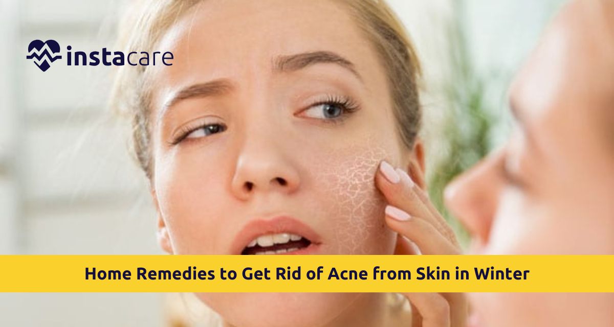 Picture of Natural Home Remedies to Get Rid of Acne from Skin in Winter