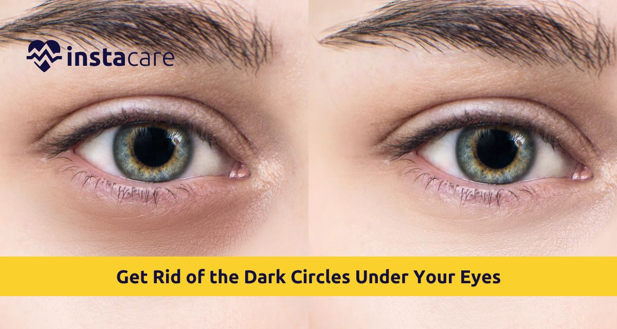 Picture of How Can You Get Rid of the Dark Circles Under Your Eyes