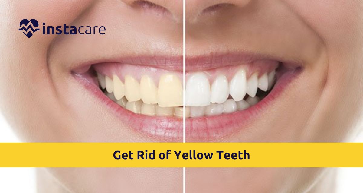 How To Get Rid Of Yellow Teeth Effective Ways To Know