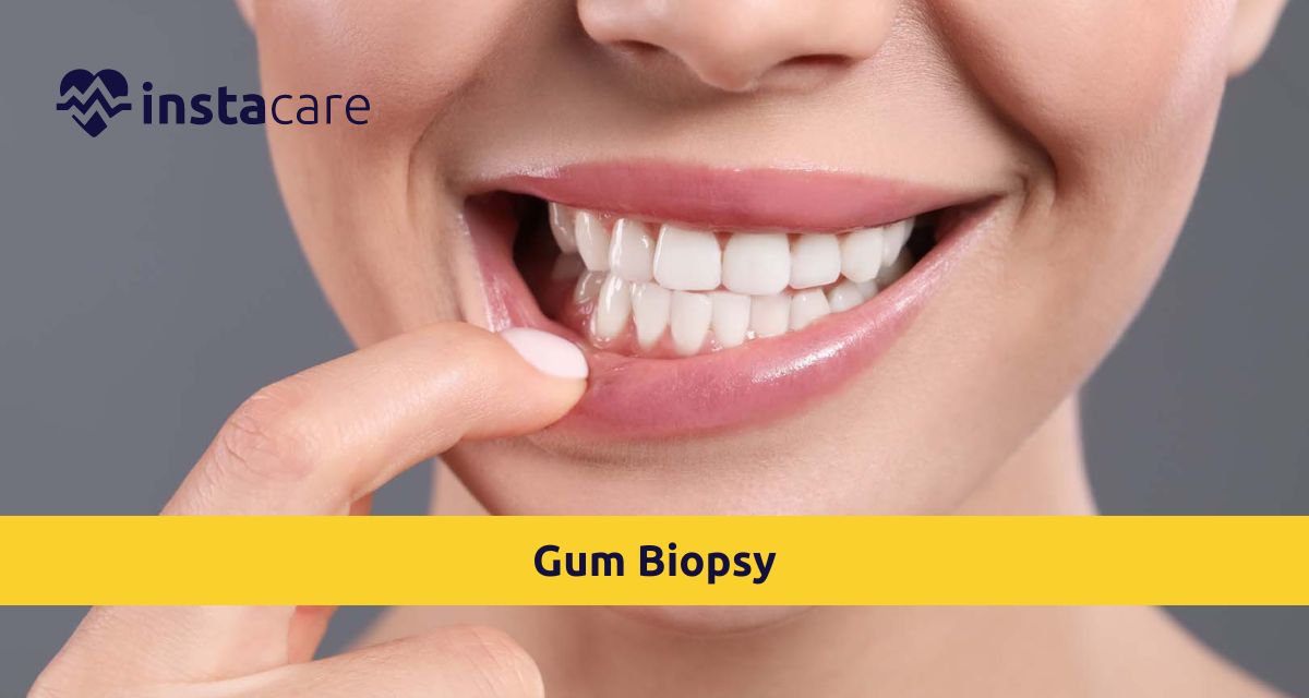 Picture of Why Do You Need a Gum Biopsy