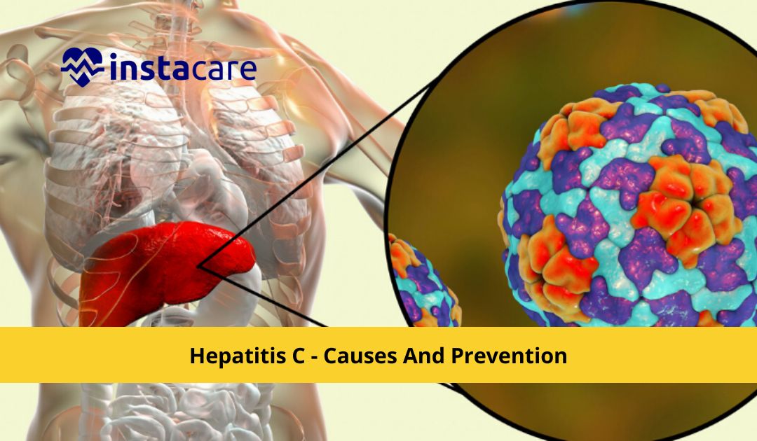 Picture of What You Must Know About Hepatitis C - Causes And Prevention