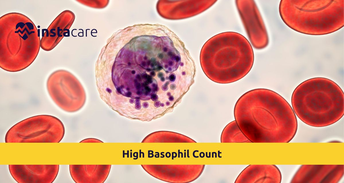 Picture of What Does It Mean To Have A High Basophil Count