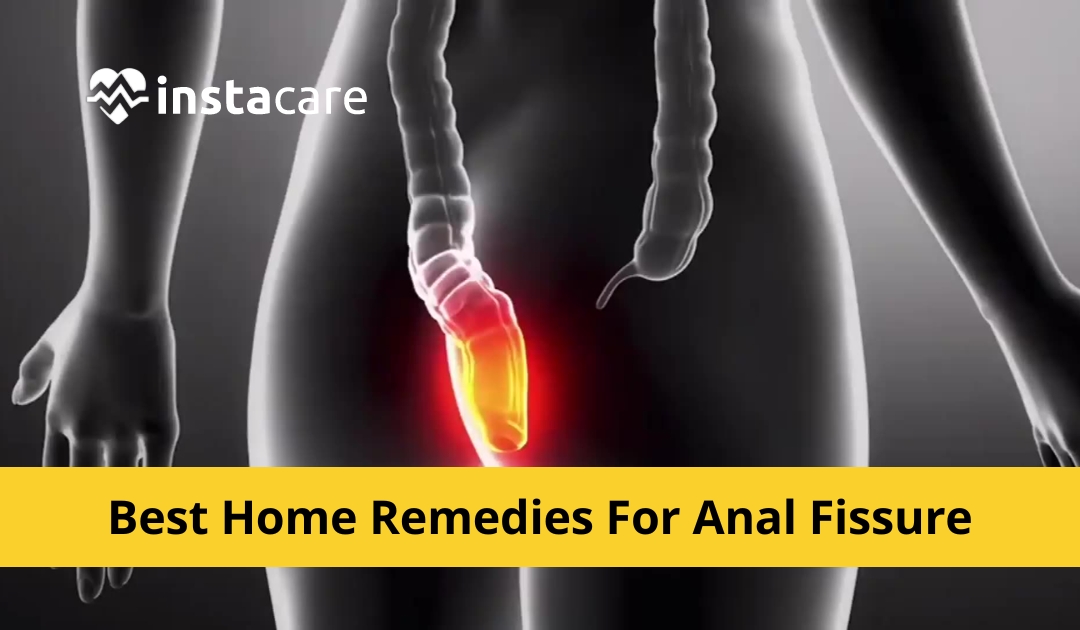 Picture of 23 Best Home Remedies For Anal Fissure