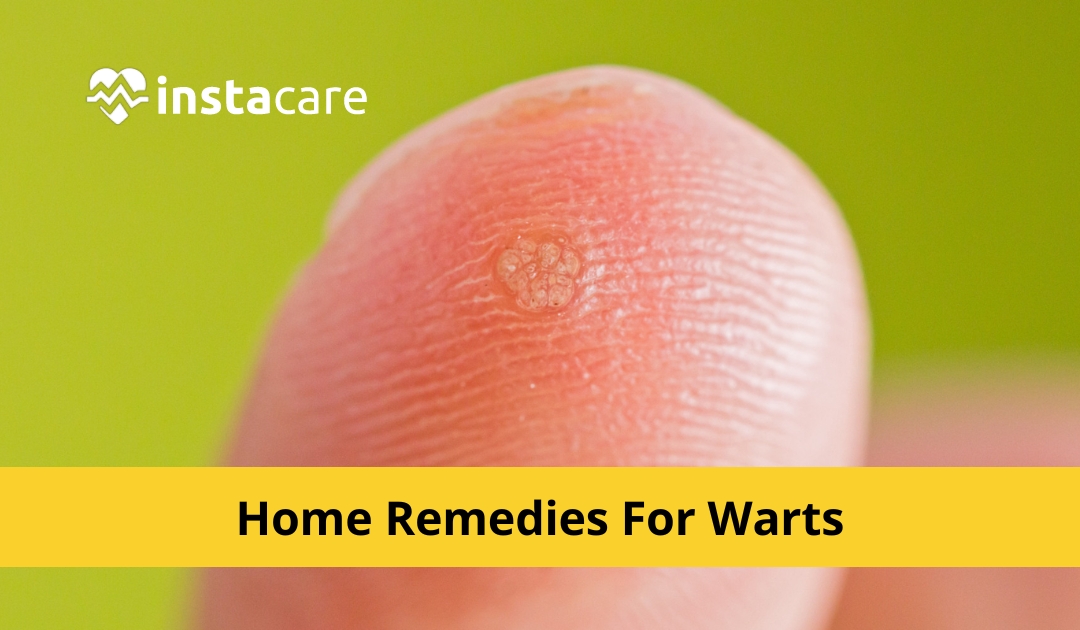 Picture of 12 Home Remedies For Warts