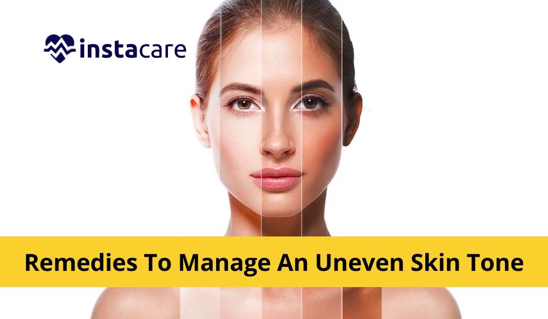 Picture of 9 Home Remedies To Manage An Uneven Skin Tone