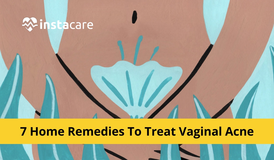 Vaginal Acne: How to Treat Acne in Your Private Parts