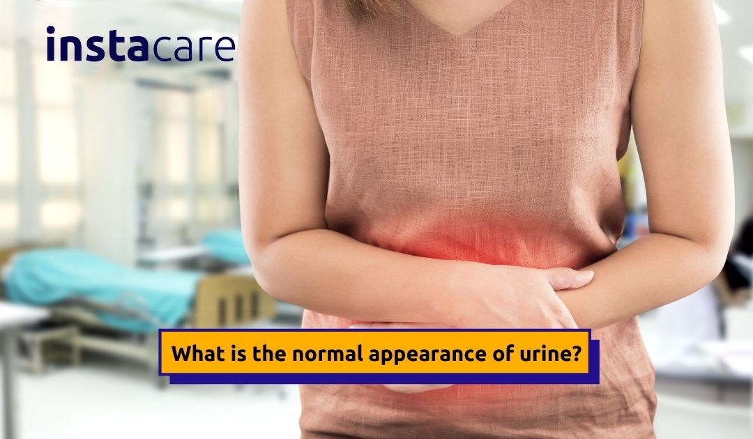 Picture of How Can You Describe the Urine and Its Appearance