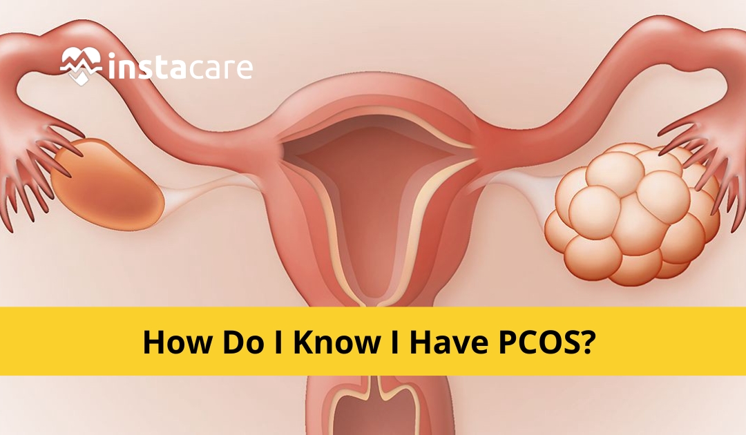 PCOS & Spotting: Is It Normal? And How Do You Manage It? – MyOva