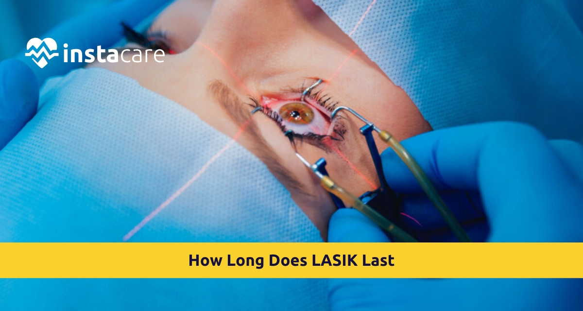 Picture of How Long Does LASIK Last