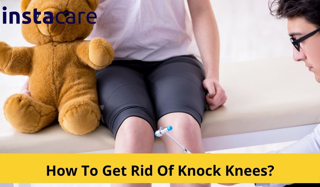 Picture of How To Get Rid Of Knock Knees Causes Symptoms Treatment