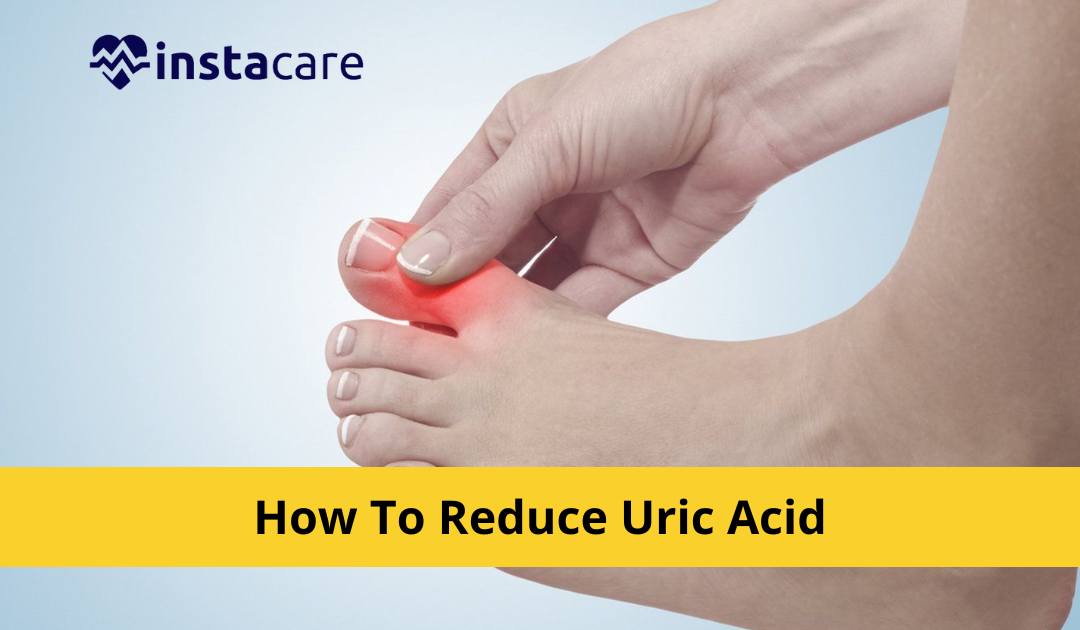 Picture of How To Reduce Uric Acid