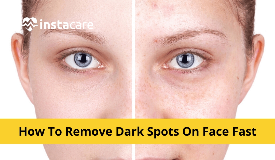 How to Remove Old Scars and Black Spots on the Legs  Age spots on face,  Face serum dark spots, Beauty hacks eyelashes