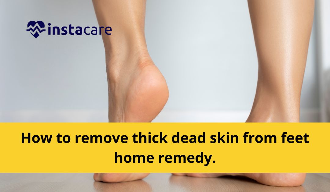 Picture of How To Remove Thick Dead Skin From Feet At Home - Proven Remedies 