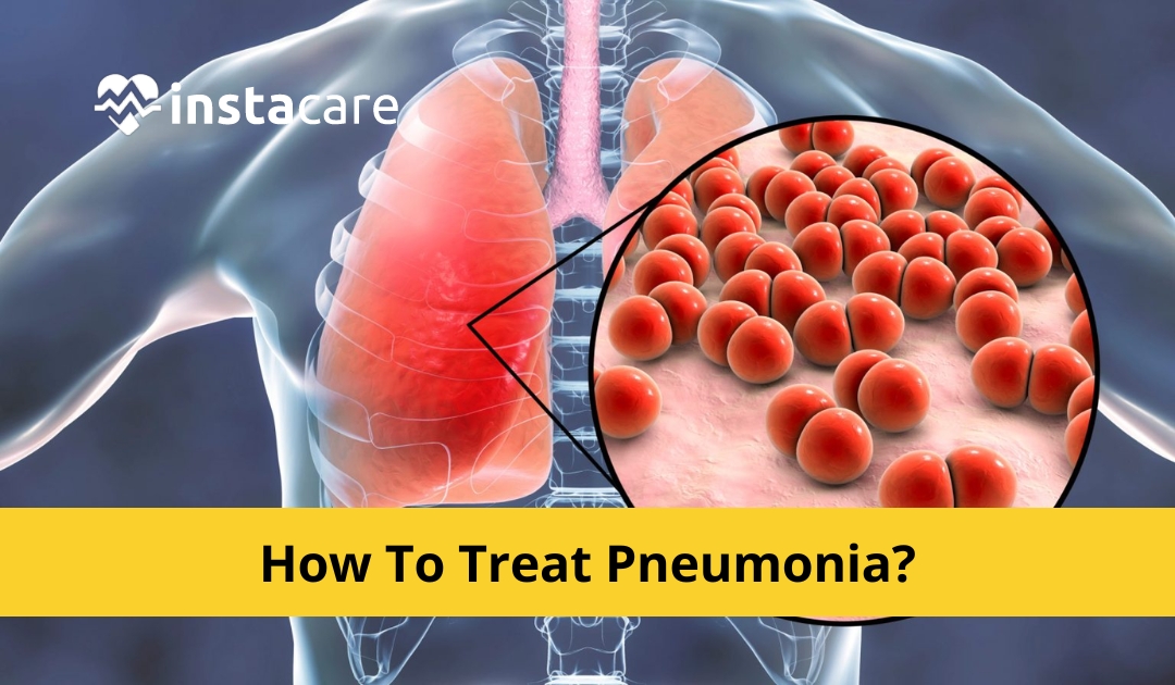 Picture of How To Treat Pneumonia