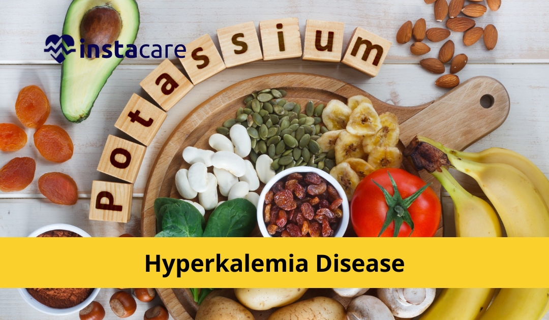 Picture of Hyperkalemia - Causes Symptoms Diagnosis Treatment